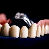 Dentallabor Wohlfart & Herkel GmbH